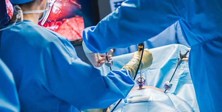 Laparoscopic Surgery