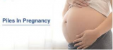Pregnancy Piles by Gopal Rao
