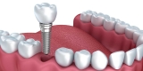 How This New Jersey Oral Surgery Clinic is Making A Mark?