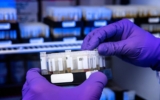 Granulin: The Multifunctional Protein with Promising Therapeutic Potential